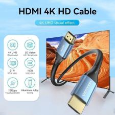 Cable HDMI 2.0 4K Vention ALHSG/ HDMI Macho - HDMI Macho/ 1.5m/ Azul